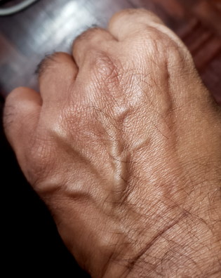 Is it possible to detect clogged arteries